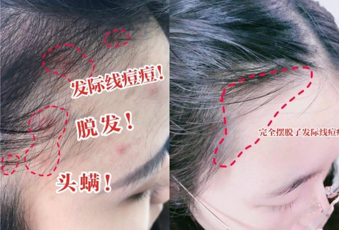 技干发帽三分钟速干轻松告别湿哒哒！新葡京娱乐场app女生值得用的黑科(图14)